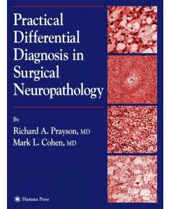Practical Differential Diagnosis in Surgical Neuropathology - Mark L. Cohen, Richard A. Prayson