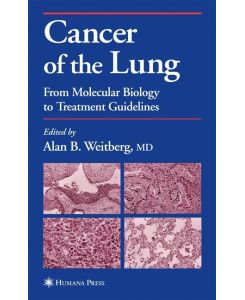 Cancer of the Lung From Molecular Biology to Treatment Guidelines