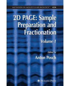 2D PAGE: Sample Preparation and Fractionation Volume 1 - Anton Posch