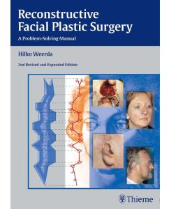 Reconstructive Facial Plastic Surgery A Problem-Solving Manual - Hilko Weerda